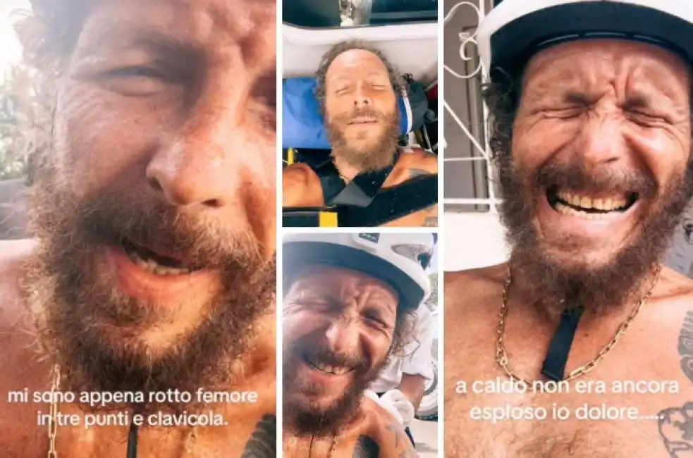 jovanotti dopo l incidente in bicicletta a santo domingo - 2