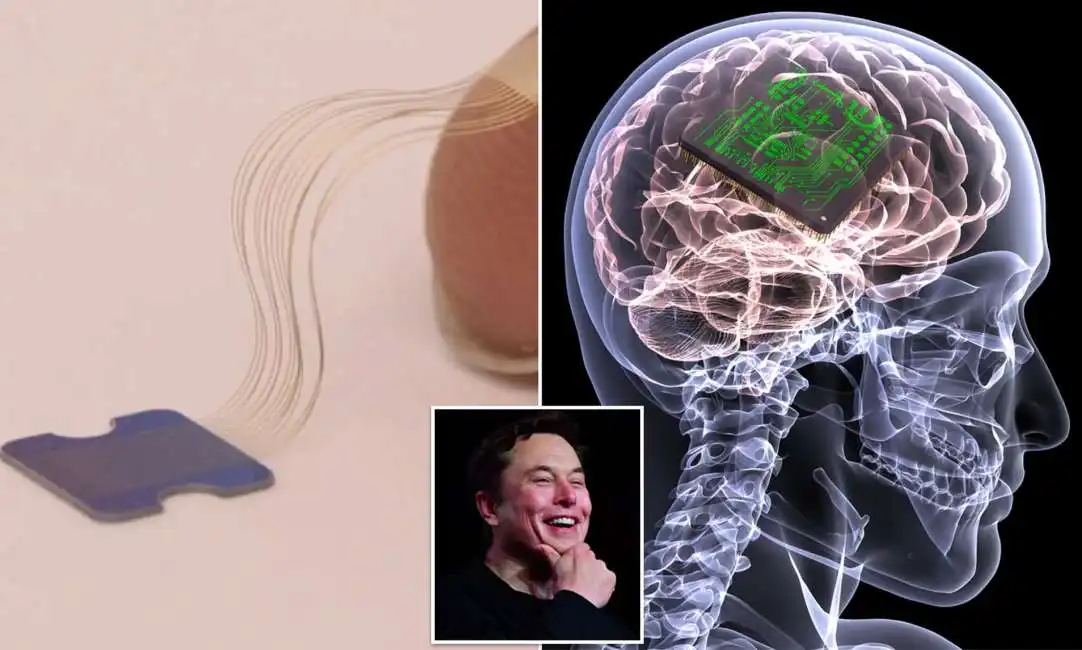 elon musk neuralink 