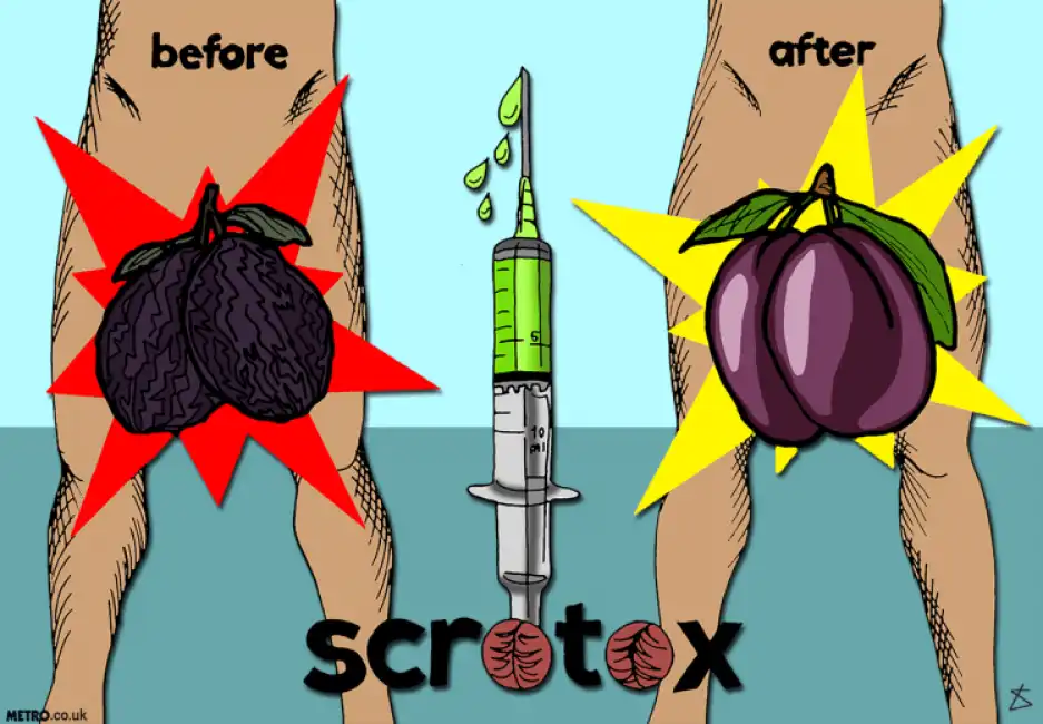 scrotox - iniezione di botox nelle palle 