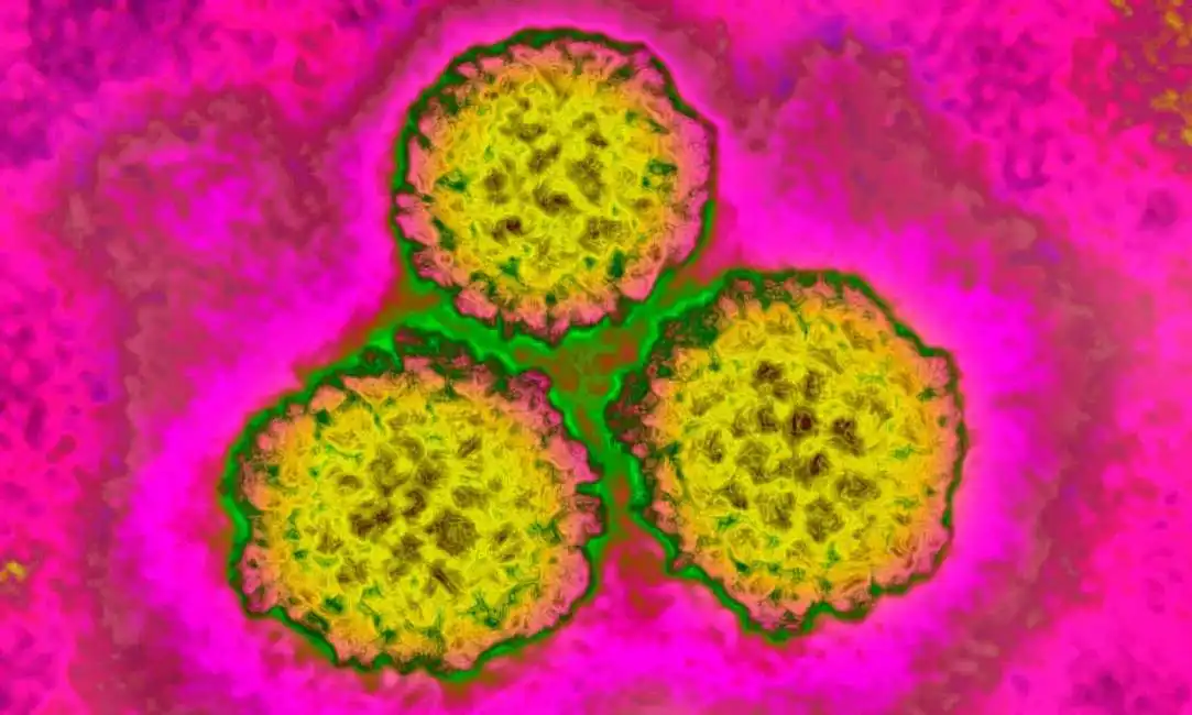 papilloma virus