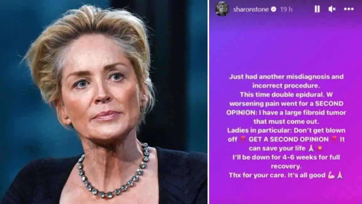 sharon stone tumore