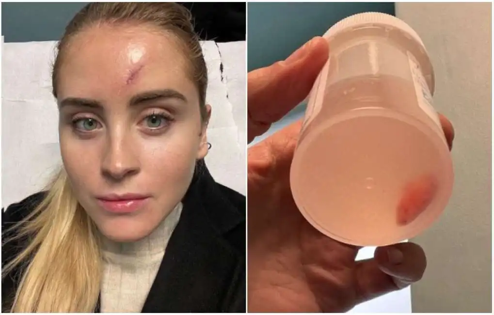 valentina ferragni e il carcinoma